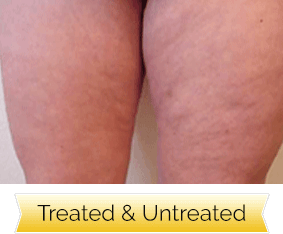 Gretchen's before and after