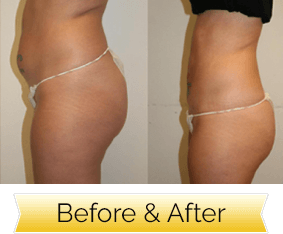 Jennifer's before and after